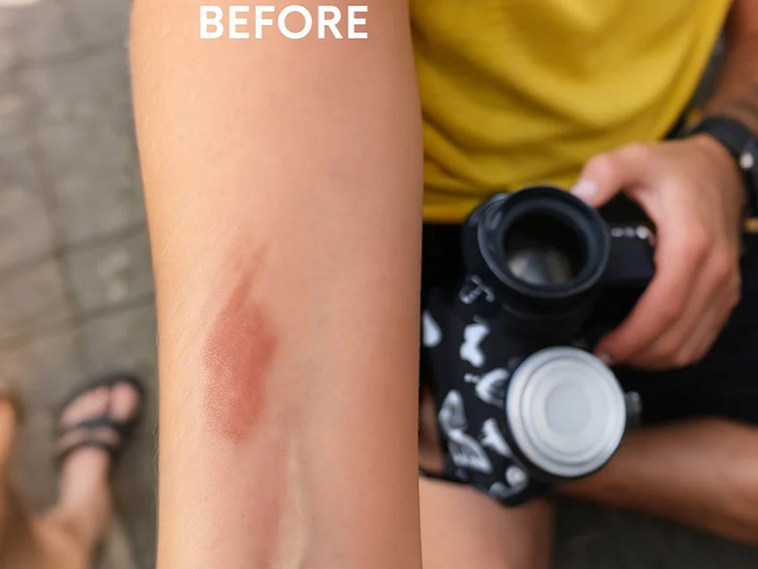image comparison before